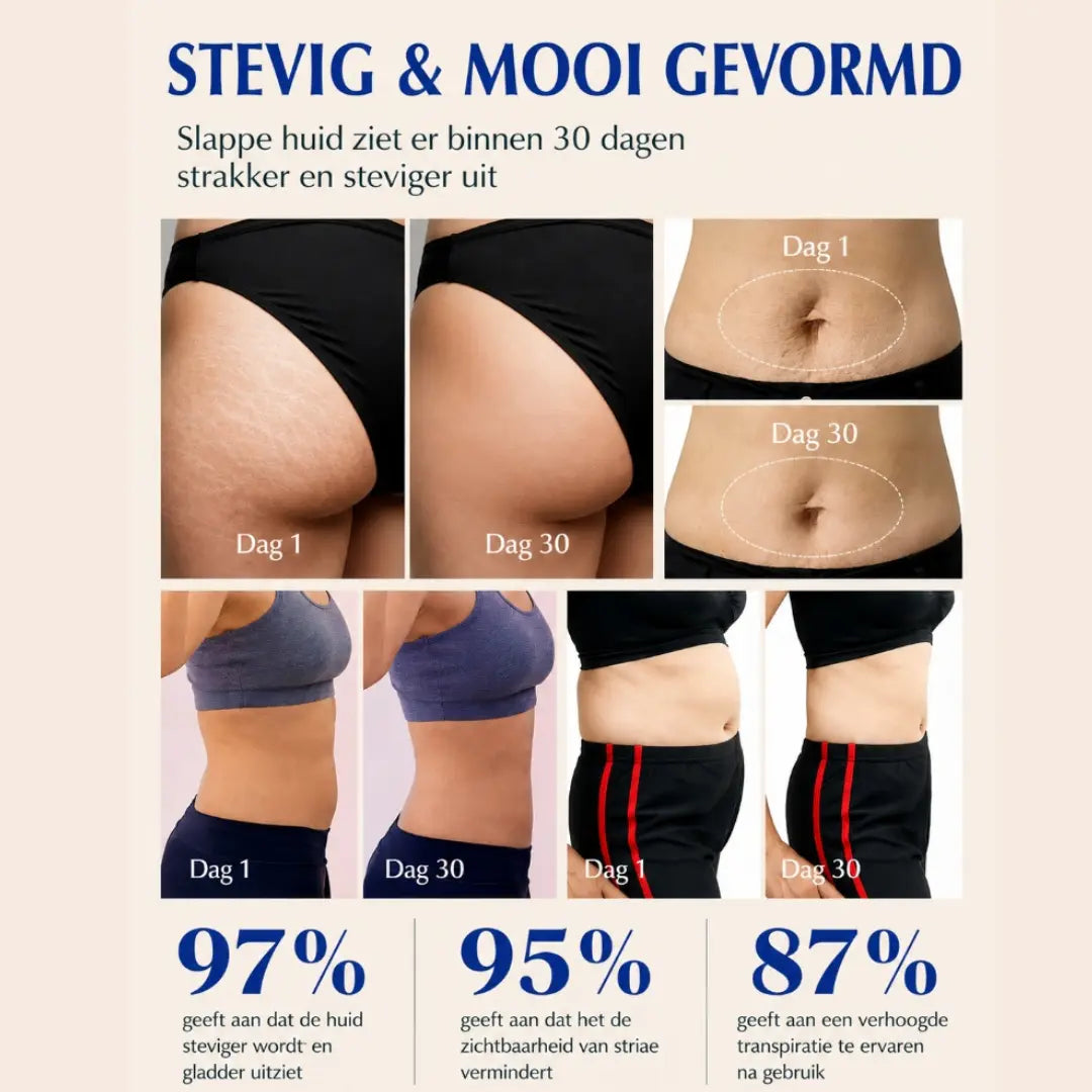 Draxory Verstevigende crème tegen cellulitis & hydraterende bodylotion voor een egalere huid